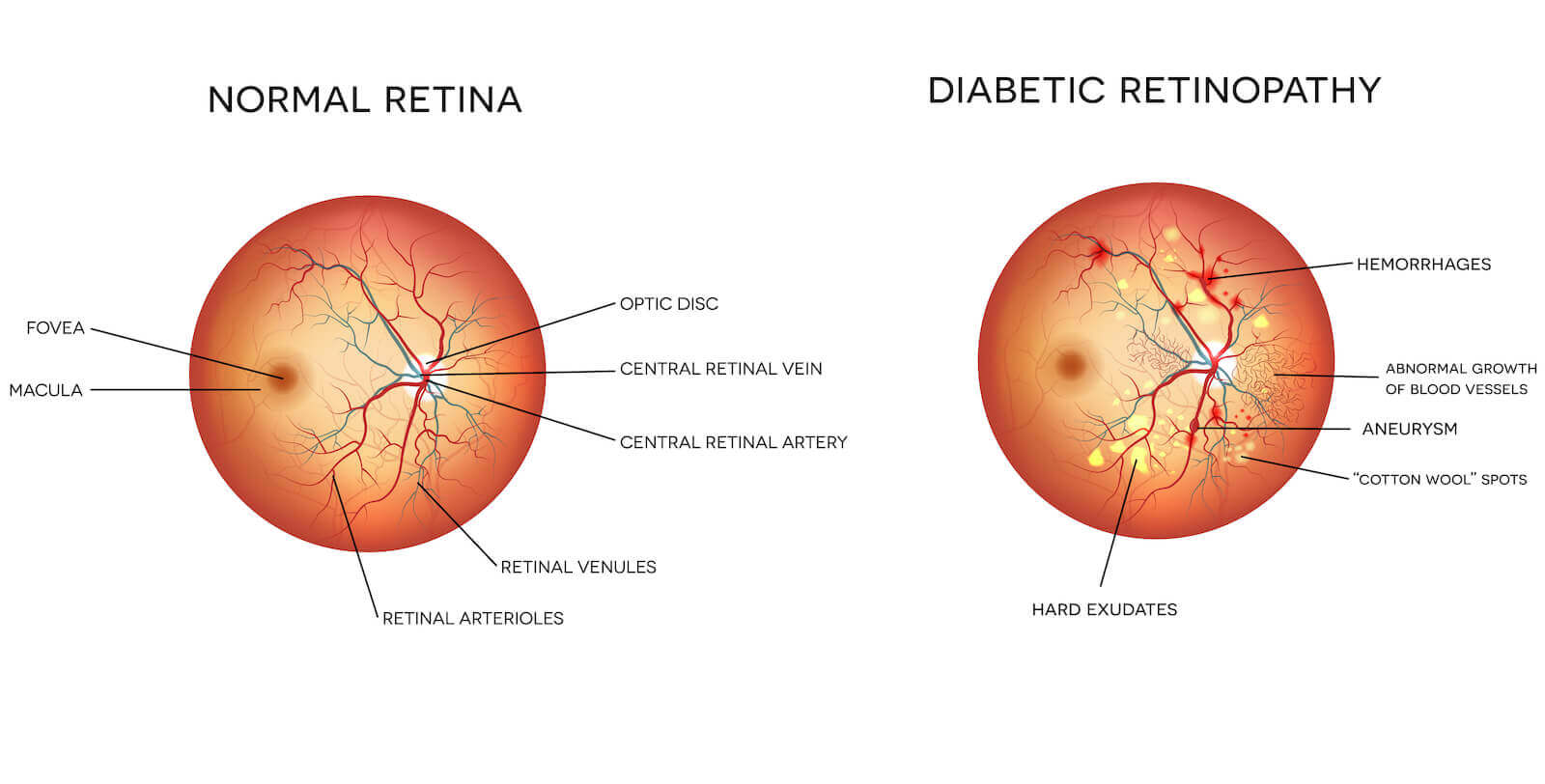 About the Eye, Eye Care Atlanta, Retina Care Atlanta